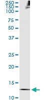 Anti-TXN Antibody Pair