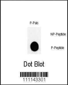 Anti-JUN Rabbit Polyclonal Antibody (Biotin)