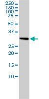 Anti-SNRPA Mouse Monoclonal Antibody [clone: 3F9-1F7]