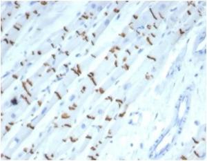 Immunohistochemical analysis of formalin-fixed, paraffin-embedded human heart tissue using Anti-N Cadherin Antibody [CDH2/7070R]