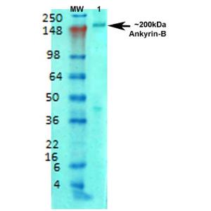 Analysis of nucleus using Anti-Ankyrin B Antibody [S105-13] (A304742). Magnification: 60X.(A) DAPI (blue) nuclear stain. (B) Phalloidin Texas Red F-Actin stain. (C) Anti-Ankyrin B Antibody [S105-13] (A304742). (D) Composite