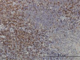 Anti-PRKCA Mouse Monoclonal Antibody [clone: 2F11]