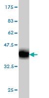 Anti-CASP1 Mouse Monoclonal Antibody [clone: 3D2]