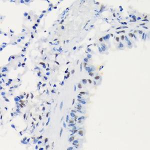 Immunohistochemistry analysis of paraffin-embedded mouse lung using Anti-LIG1 Antibody [ARC1514] (A307677) at a dilution of 1:100 (40x lens). Perform microwave antigen retrieval with 10 mM Tris/EDTA buffer pH 9.0 before commencing with IHC staining protocol.