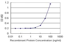 Anti-TREM1 Polyclonal Antibody Pair