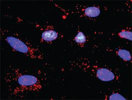 Anti-TRAF2 + ERN1 Antibody Pair