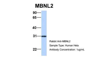 Anti-MBNL2 Rabbit Polyclonal Antibody