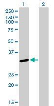 Anti-SNRPA Mouse Monoclonal Antibody [clone: 3F9-1F7]