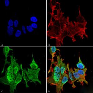 Immunocytochemistry/Immunofluorescence analysis of human neuroblastoma cell line (SK-N-BE, fixed in 4% formaldehyde for 15  min at room temperature, using Anti-Ankyrin B Antibody [S105-13] (A304742), at 1:100 for 60  minutes at room temperature.