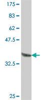 Anti-IER5 Mouse Polyclonal Antibody