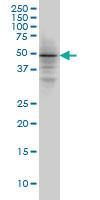 Anti-SMAD3 Mouse Monoclonal Antibody [clone: 4D4]