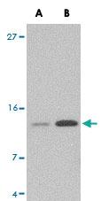 Anti-Strep tag II Polyclonal Antibody