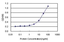 Anti-ACY1 Antibody Pair