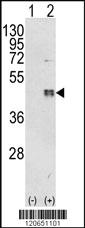 Anti-CEBPB Rabbit Polyclonal Antibody