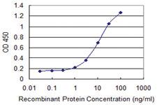 Anti-NBN Mouse Monoclonal Antibody [clone: 2C7]