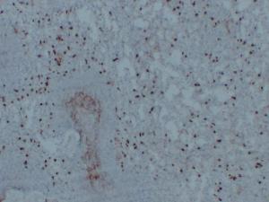 Immunohistochemical analysis of paraffin-embedded human Spleen using Anti-CD14 Antibody