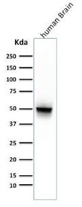 Antibody anti-GFAP astro 789 100 µg