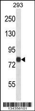 Anti-ACSL4 Rabbit Polyclonal Antibody (FITC (Fluorescein Isothiocyanate))