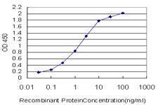 Anti-SNRPA Mouse Monoclonal Antibody [clone: 3F9-1F7]