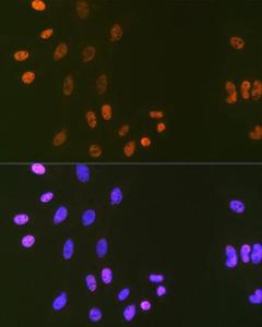 Immunofluorescence analysis of C6 cells using Anti-LIG1 Antibody [ARC1514] (A307677) at a dilution of 1:100 (40x lens). DAPI was used to stain the cell nuclei (blue).