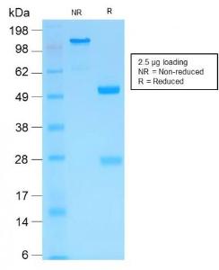 SDS-PAGE analysis of Anti-MMP3 Antibody [MMP3/1994R] under non-reduced and reduced conditions; showing intact IgG and intact heavy and light chains, respectively SDS-PAGE analysis confirms the integrity and purity of the antibody