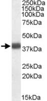 Anti-APOL2 Goat Polyclonal Antibody