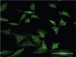 Anti-SEC63 Mouse Monoclonal Antibody [clone: 1A8]