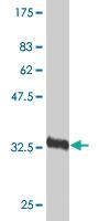 Anti-FGFR1 Mouse Monoclonal Antibody [clone: 1B12]