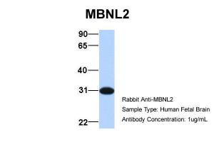 Anti-MBNL2 Rabbit Polyclonal Antibody