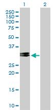 Anti-CHMP2A Mouse Polyclonal Antibody