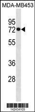 Anti-HSPA1L Rabbit Polyclonal Antibody