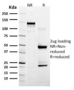 Antibody anti-GFAP astro 789 100 µg