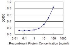 Anti-SEC63 Mouse Monoclonal Antibody [clone: 1A8]