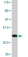 Anti-PNPLA6 Mouse Monoclonal Antibody [clone: 3D10]