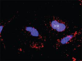 Anti-MAP3K5 + ERN1 Antibody Pair