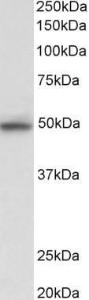 Anti-MAPK9 Antibody (A82597) (0.03 µg/ml) staining of HeLa lysate (35 µg protein in RIPA buffer). Primary incubation was 1 hour. Detected by chemiluminescence