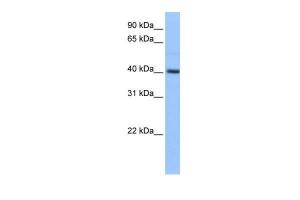 Anti-PDXK Rabbit Polyclonal Antibody