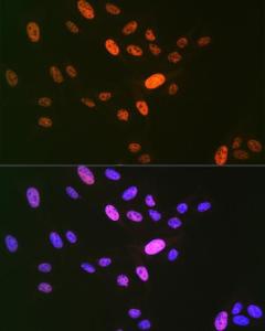 Immunofluorescence analysis of U-2 OS cells using Anti-LIG1 Antibody [ARC1514] (A307677) at a dilution of 1:100 (40x lens). DAPI was used to stain the cell nuclei (blue).