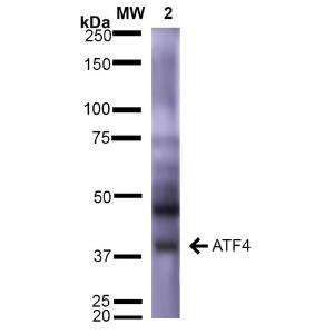 Western blot analysis of rat brain showing detection of ~39 kDa (isoform 2) ATF4 protein using Anti-ATF4 Antibody [S360A-24] (A304745) at 1:1,000 for 2 hours at room temperature Lane 1: Molecular Weight Ladder (MW) Lane 2: rat Brain Load: 15  µg Block: 5% Skim Milk in 1X TBST