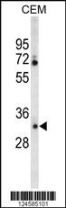 Anti-CA6 Rabbit Polyclonal Antibody