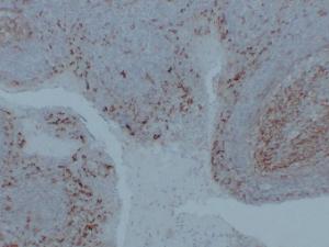 Immunohistochemical analysis of paraffin-embedded human Tonsil using Anti-CD14 Antibody