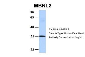 Anti-MBNL2 Rabbit Polyclonal Antibody