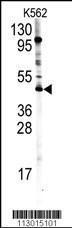 Anti-PRMT8 Rabbit Polyclonal Antibody (HRP (Horseradish Peroxidase))