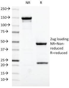 SDS-PAGE analysis of Anti-Estrogen Receptor Antibody [ESR1/420] under non-reduced and reduced conditions; showing intact IgG and intact heavy and light chains, respectively. SDS-PAGE analysis confirms the integrity and purity of the antibody