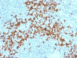 Immunohistochemical analysis of formalin-fixed, paraffin-embedded human spleen using Anti-MMP9 Antibody [2C3]