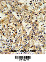 Anti-CA6 Rabbit Polyclonal Antibody