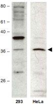 Anti-HUS1B Rabbit Polyclonal Antibody