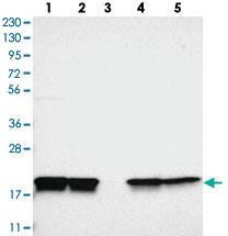 Anti-PPIB Rabbit Polyclonal Antibody