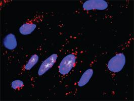 Anti-FADD + EZR Antibody Pair