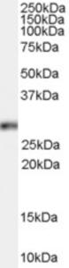 EB07495 (0.1 µg/ml) staining of HeLa cell lysate (35 µg protein in RIPA buffer).  Primary incubation was 1 hour.  Detected by chemiluminescence.